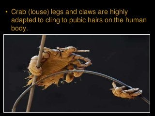 Immune System Lesson PowerPoint