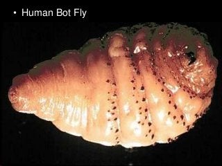 Immune System Lesson PowerPoint