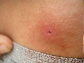 Immune System Lesson PowerPoint