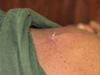 Immune System Lesson PowerPoint