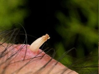 Immune System Lesson PowerPoint