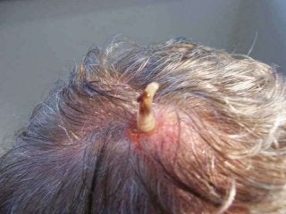 Immune System Lesson PowerPoint