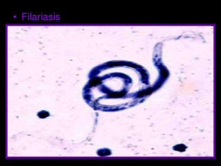 Immune System Lesson PowerPoint