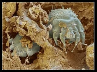 Immune System Lesson PowerPoint