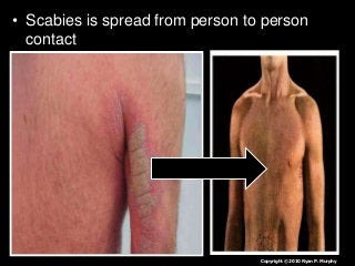 Immune System Lesson PowerPoint