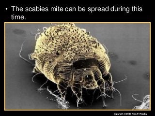 Immune System Lesson PowerPoint