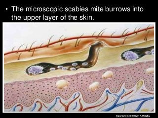 Immune System Lesson PowerPoint