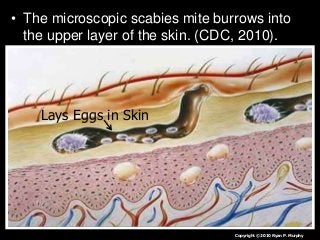 Immune System Lesson PowerPoint