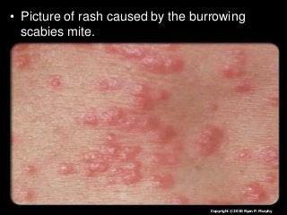 Immune System Lesson PowerPoint