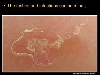 Immune System Lesson PowerPoint