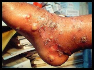 Immune System Lesson PowerPoint