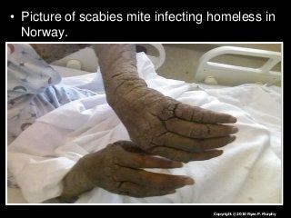 Immune System Lesson PowerPoint