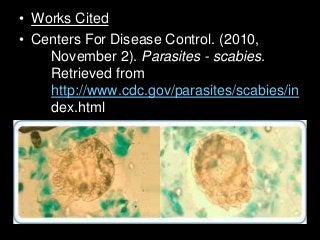 Immune System Lesson PowerPoint