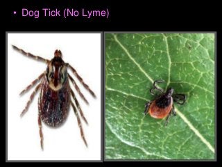 Immune System Lesson PowerPoint