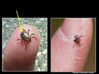 Immune System Lesson PowerPoint