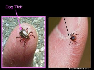 Immune System Lesson PowerPoint