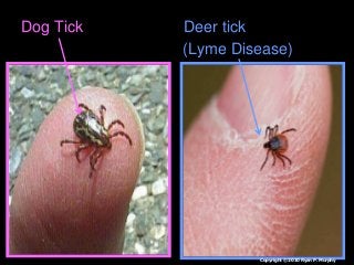 Immune System Lesson PowerPoint