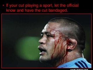 Immune System Lesson PowerPoint