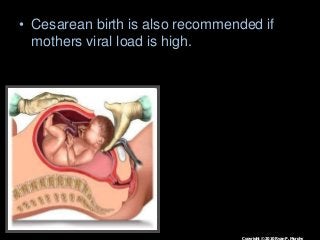 Immune System Lesson PowerPoint