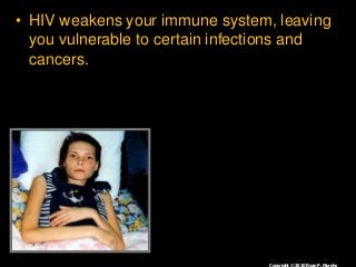 Immune System Lesson PowerPoint