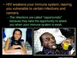 Immune System Lesson PowerPoint