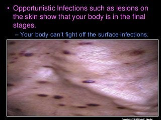 Immune System Lesson PowerPoint