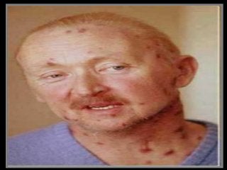 Immune System Lesson PowerPoint