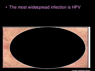 Immune System Lesson PowerPoint