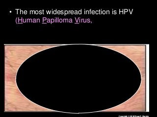 Immune System Lesson PowerPoint