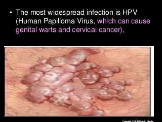 Immune System Lesson PowerPoint