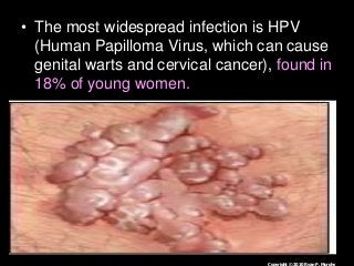 Immune System Lesson PowerPoint