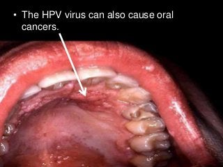 Immune System Lesson PowerPoint