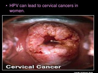 Immune System Lesson PowerPoint