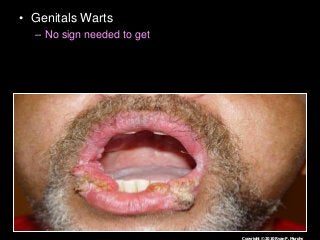 Immune System Lesson PowerPoint