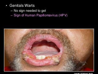 Immune System Lesson PowerPoint