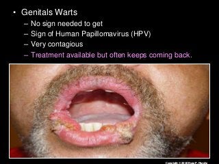 Immune System Lesson PowerPoint