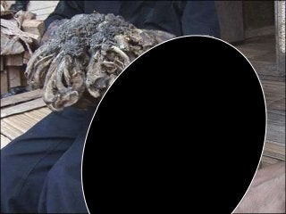 Immune System Lesson PowerPoint