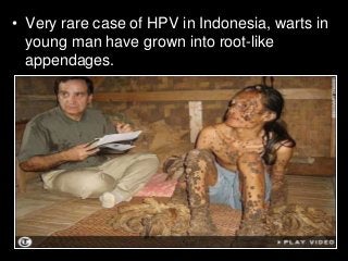 Immune System Lesson PowerPoint