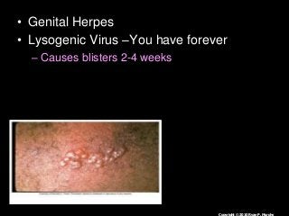 Immune System Lesson PowerPoint