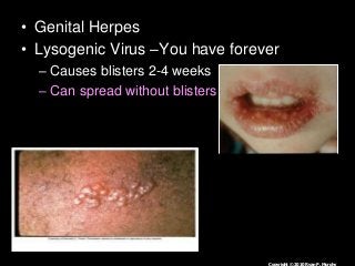 Immune System Lesson PowerPoint