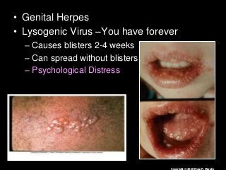 Immune System Lesson PowerPoint