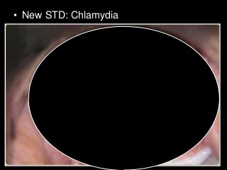 Immune System Lesson PowerPoint