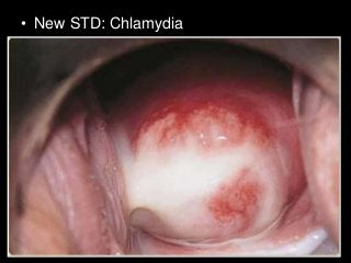 Immune System Lesson PowerPoint