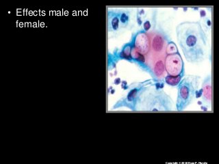 Immune System Lesson PowerPoint