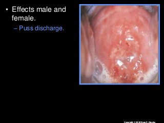 Immune System Lesson PowerPoint