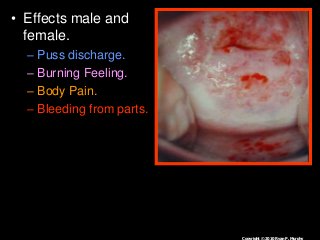 Immune System Lesson PowerPoint