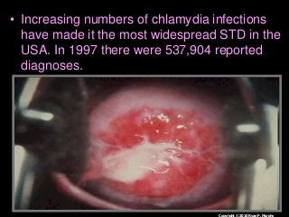 Immune System Lesson PowerPoint