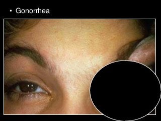 Immune System Lesson PowerPoint