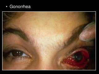 Immune System Lesson PowerPoint