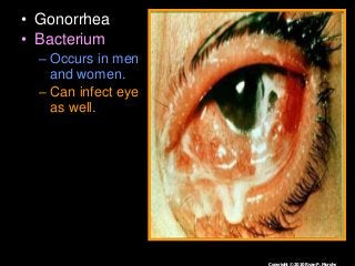 Immune System Lesson PowerPoint